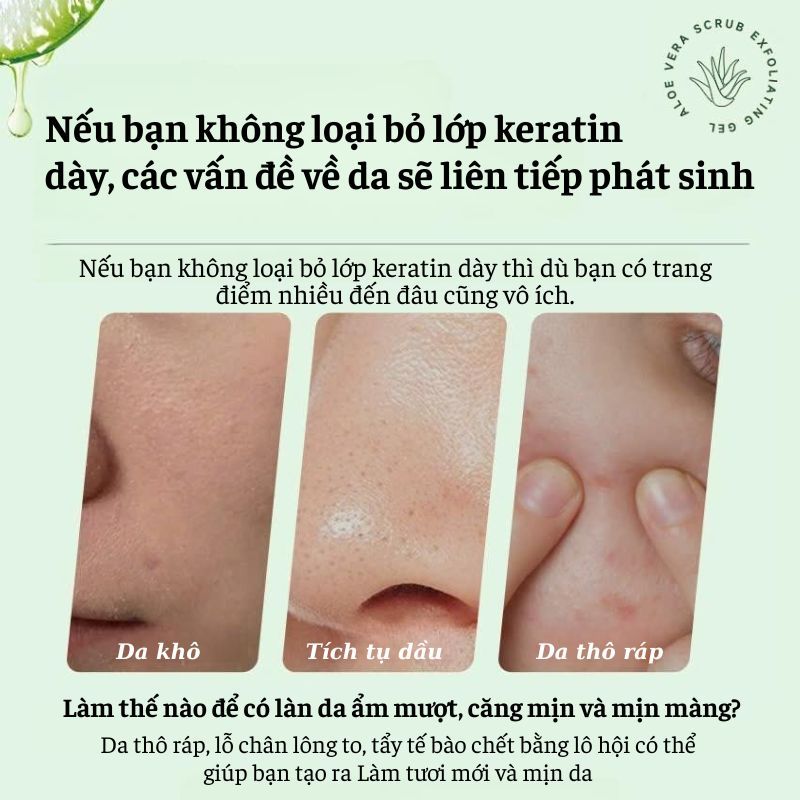 Gel Tẩy Da Chết Nha Đam 100ML Cho Da Nhạy Cảm – Làm Sạch Nhẹ Nhàng, Dưỡng Ẩm, Hỗ Trợ Sáng Da