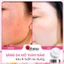 Kem Dưỡng Ẩm Collagen Kihasu Peptide 6in1 Giúp Da Căng Bóng, Trắng Sáng Tự Nhiên, Mờ Nám