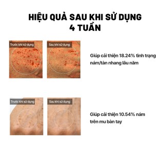 Serum Chống Nắng Arocell Mela TXA Sun Serum SPF50+ PA++++ Chống Tia UV Dưỡng Ẩm Hỗ Trợ Làm Sáng Da 40ml