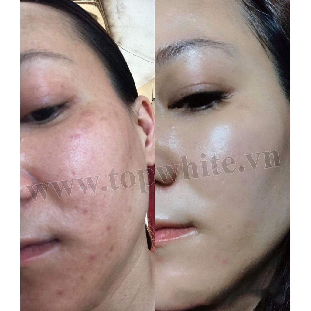 Kem dưỡng giúp làm mờ thâm nám, tàn nhang, đồi mồi White Perfect D2 Skin Power Cream