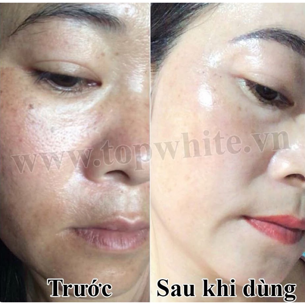 Kem dưỡng trắng trông căng bóng da White Perfect D1S Renew Skin Cream