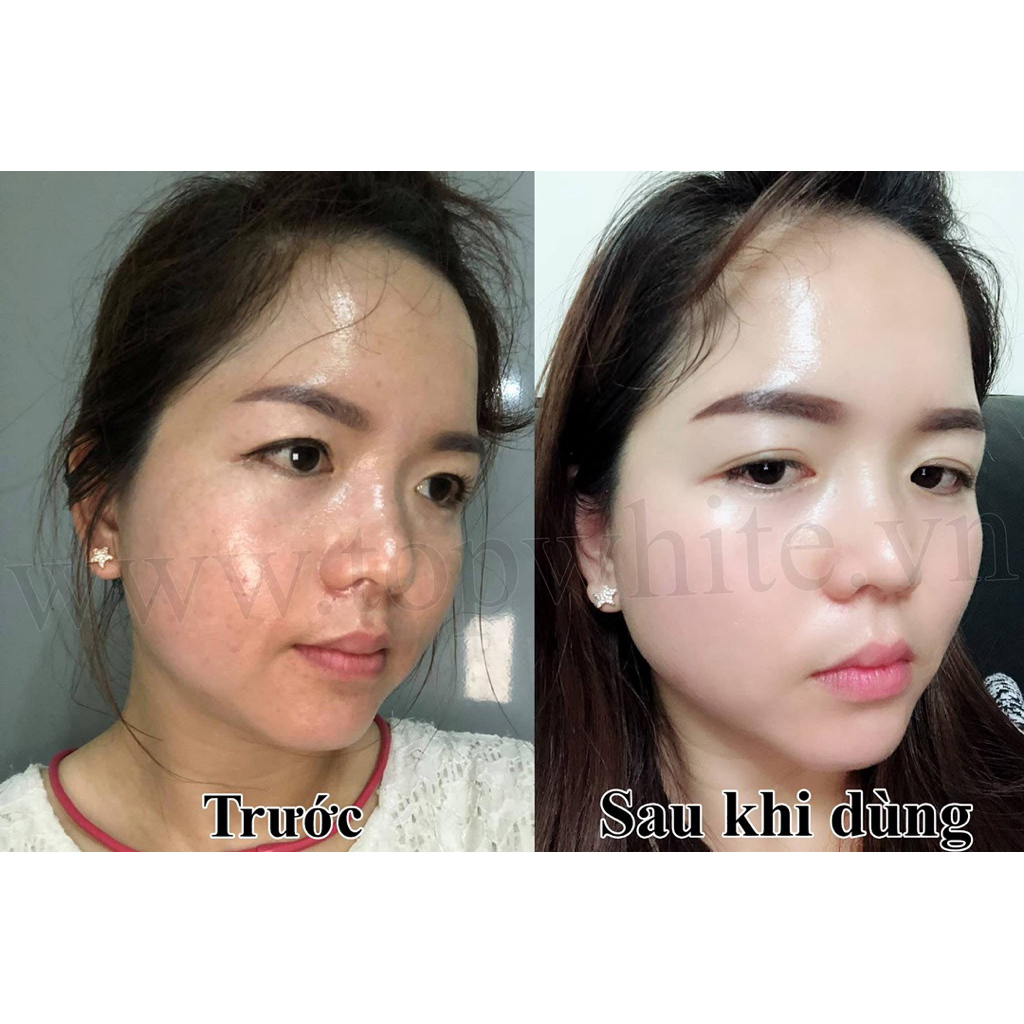Kem dưỡng trắng trông căng bóng da White Perfect D1S Renew Skin Cream
