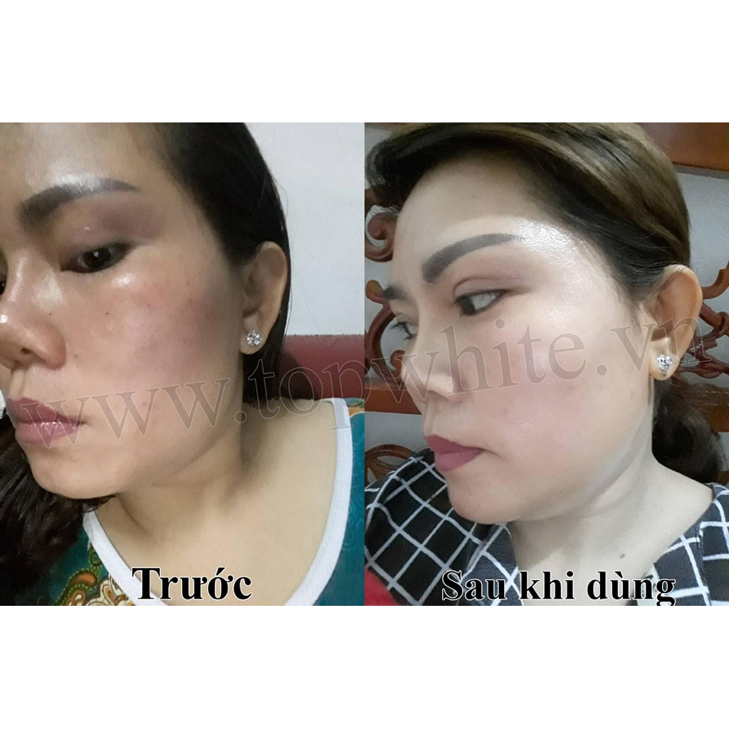 Kem dưỡng trắng trông căng bóng da White Perfect D1S Renew Skin Cream