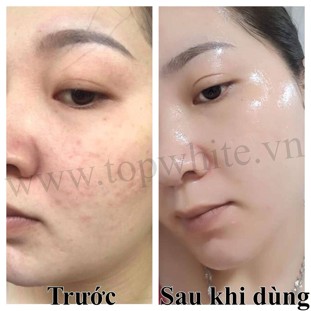 Kem dưỡng trắng trông căng bóng da White Perfect D1S Renew Skin Cream
