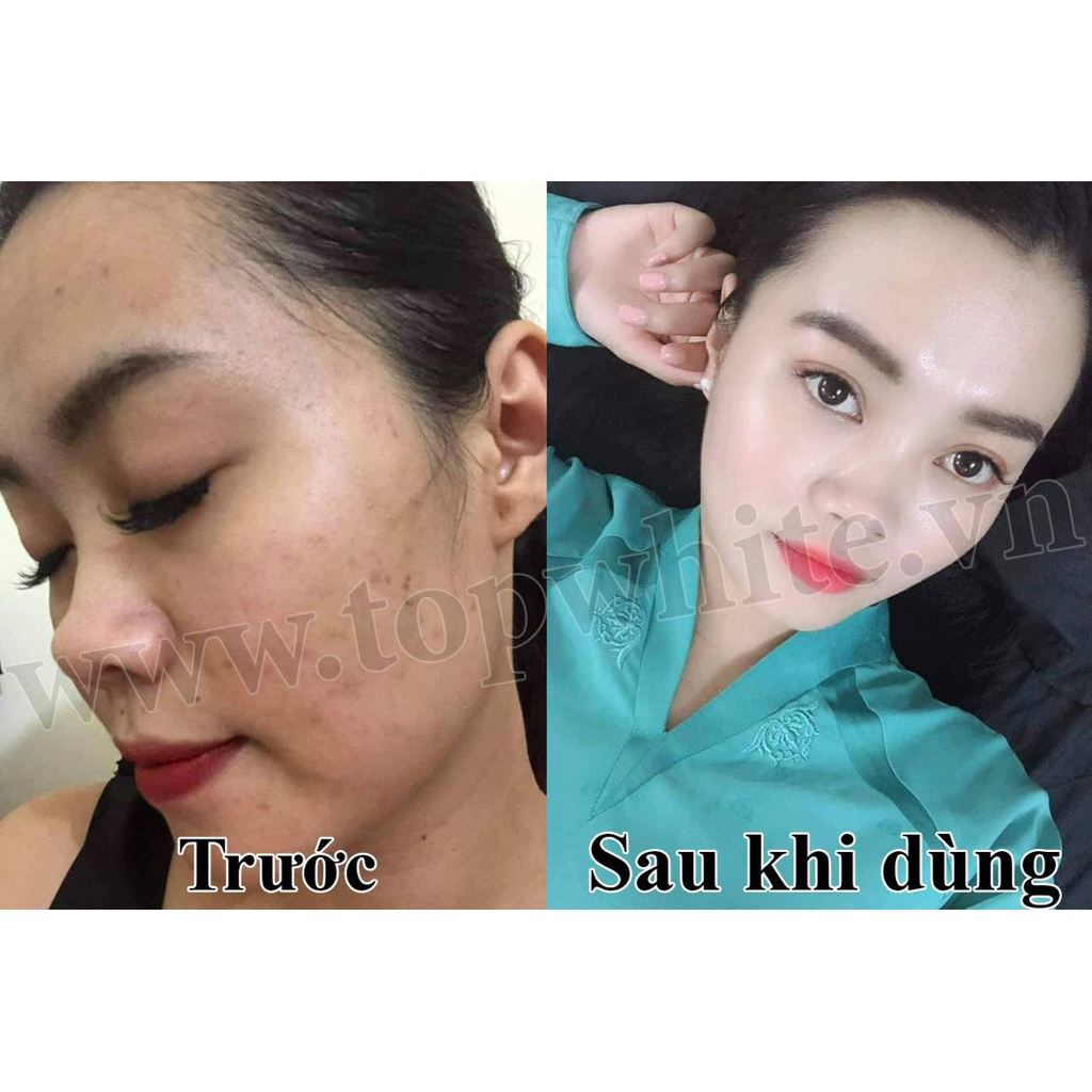 Kem dưỡng trắng trông căng bóng da White Perfect D1S Renew Skin Cream