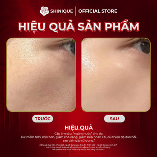 SHINIQUE Revitalizing HA Booster Serum 30ml - Serum với 8 Loại HA Đa Phân Tử, Phức Hợp 5 Peptide, Pentavitin, Cấp Ẩm 72H