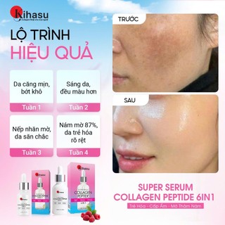 Serum Collagen Mờ Nám Kihasu 6in1 Combo 2 Chai và 3 Chai Collagen Nhật Nano,Mờ Thâm, Dưỡng Sáng, Phục Hồi Da Yếu