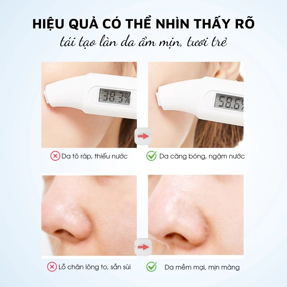 Toner Vitamin E & Glycerin 100ml – Cấp Ẩm, Làm Dịu Da, Cân Bằng Da, Hỗ Trợ Phục Hồi Sau Nắng
