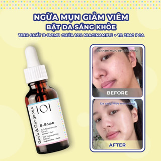 Tinh Chất Geek&Gorgeous B-Bomb 10% Niacinamide Kiềm Dầu, Hỗ Trợ Kháng Viêm, Cải Thiện Mụn 30ml