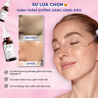 Tinh Chất Geek & Gorgeous aPAD 20% Azelaic Acid Mờ Thâm, Dưỡng Sáng, Kiểm Soát Dầu 30ml Duduhouse