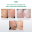 BỘ 3 AMPOULE TẾ BÀO GỐC GSC