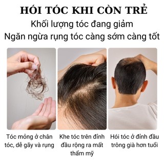 Dầu gội gừng Đồng Nhân Đường 520ml chống rụng tóc, hỗ trợ mọc tóc, tóc dày khoẻ, sạch gàu - ngứa, kiểm soát dầu