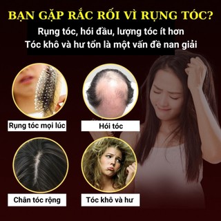 Dầu gội gừng Đồng Nhân Đường 520ml chống rụng tóc, hỗ trợ mọc tóc, tóc dày khoẻ, sạch gàu - ngứa, kiểm soát dầu