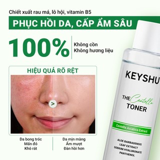 Nước Cân Bằng KEYSHU The Centella Hỗ Trợ Làm Dịu Vùng Da Nhạy Cảm, Phục Hồi Da 150ml