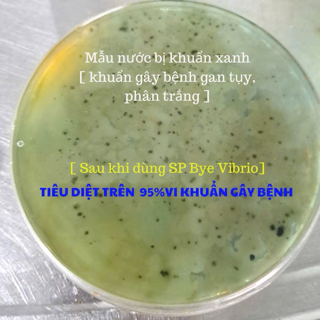 BYE VIBRIO VI SINH ĂN KHUẨN VIBRIO
