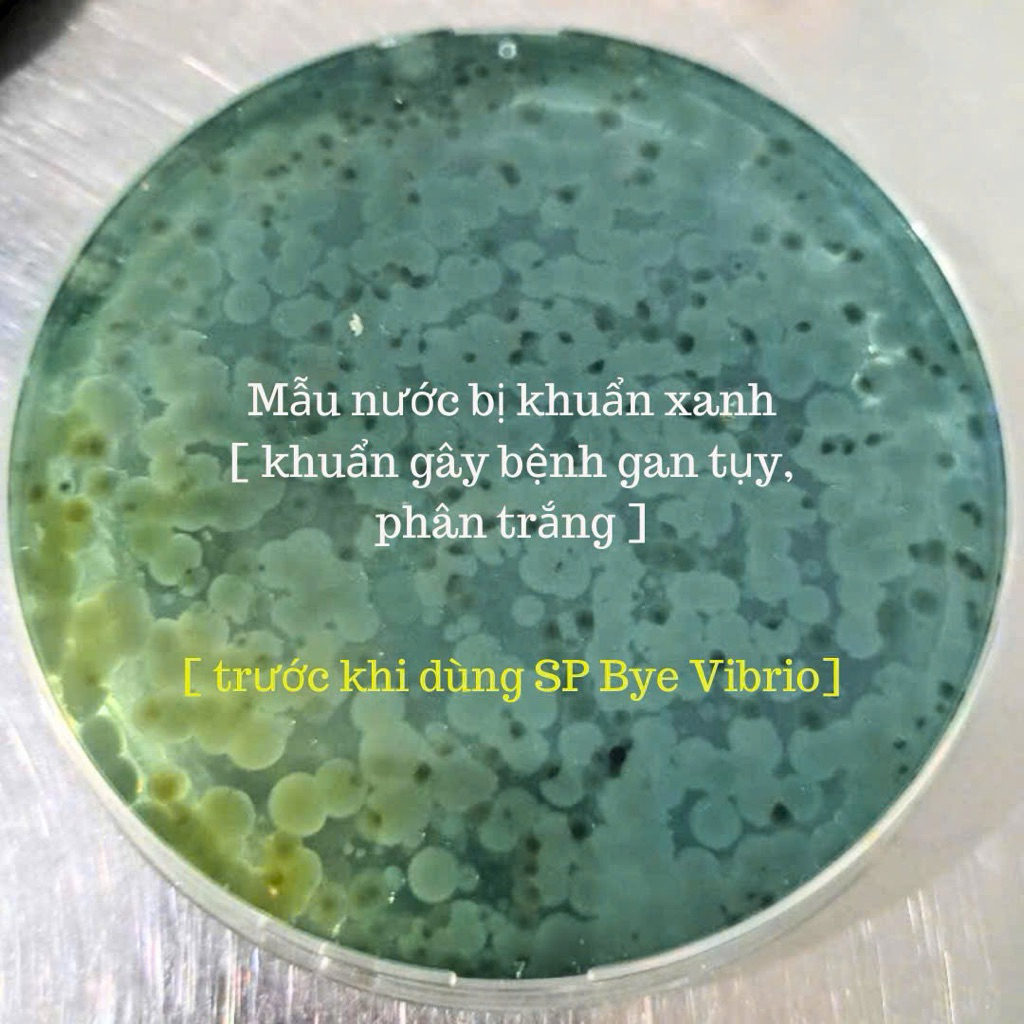 BYE VIBRIO VI SINH ĂN KHUẨN VIBRIO