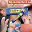 combo 5 tuýp/ KEM BÔI NẤM NGỨA – GIẢM NGỨA, LÀM DỊU DA, HỖ TRỢ PHỤC HỒI DA , Nấm Móng, Hắc Lào, Tổ Đỉa, Á Sừng