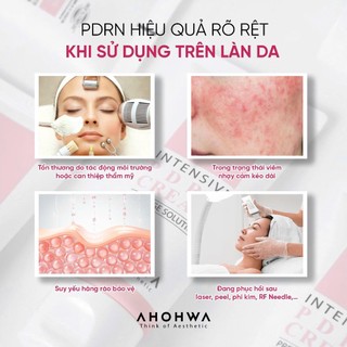 Ahohwa - Intensive PDRN Cream - Kem tái thiết làn da nguyên bản, phục hồi trẻ hóa cấp độ tế bào 12gr