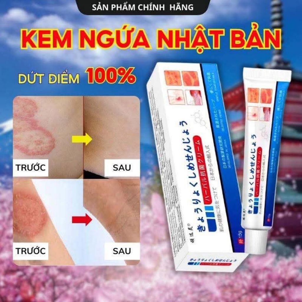 Kem bôi nhật hỗ trợ nấm da, giảm ngứa, mẩn đỏ, dùng ngoài da an toàn
