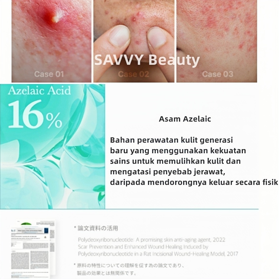 Tinh Chất Medicube 16 Azelaic Acid BB Ampoule 30ml Giảm Mụn, Mờ Thâm, Làm Dịu Da
