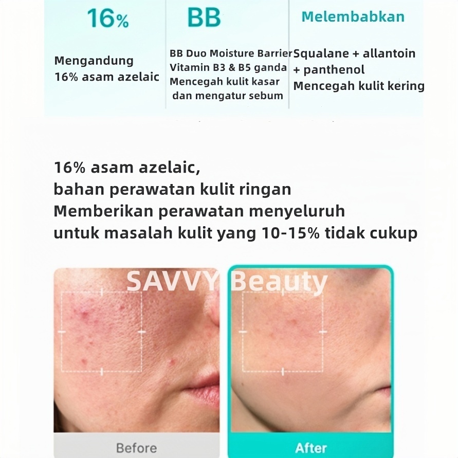 Tinh Chất Medicube 16 Azelaic Acid BB Ampoule 30ml Giảm Mụn, Mờ Thâm, Làm Dịu Da