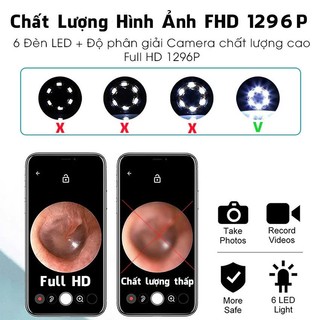 Dụng Cụ Lấy Ráy Tai Có Gắn Camera Nội Soi Full HD Đa Năng - Kết Nối Điện Thoại - Bảo Hành 12 Tháng
