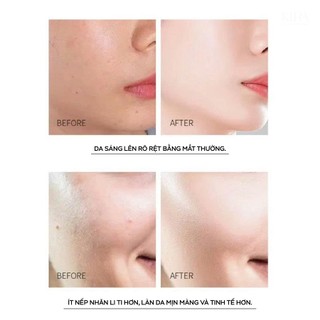 Mặt nạ làm đẹp thiết bị trị liệu ánh sáng 7 màu, thiết bị làm đẹp mặt nạ ánh sáng LED silicon