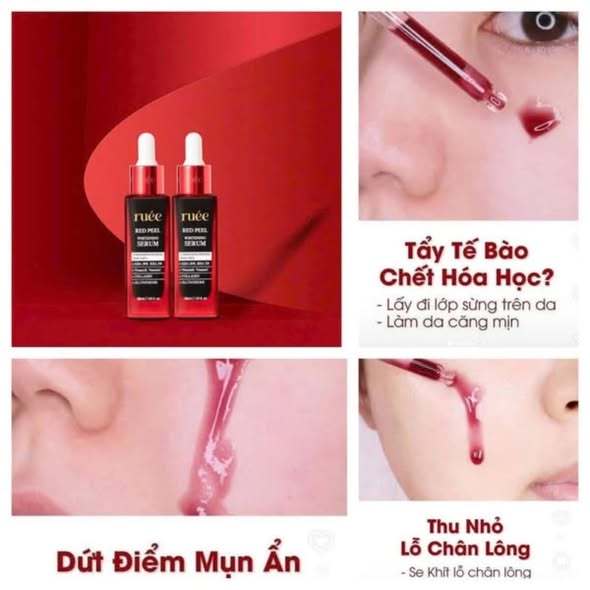Peel Da Sinh Học Ruée - Loại bỏ tế bào chết sâu, giảm mụn,căng bóng cấp ấm trắng sáng 30ml