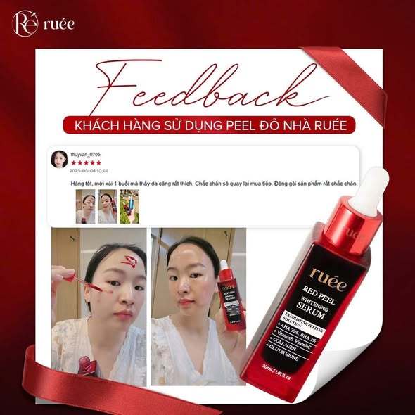 Peel Da Sinh Học Ruée - Loại bỏ tế bào chết sâu, giảm mụn,căng bóng cấp ấm trắng sáng 30ml