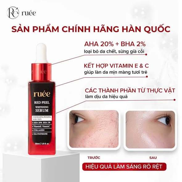 Peel Da Sinh Học Ruée - Loại bỏ tế bào chết sâu, giảm mụn,căng bóng cấp ấm trắng sáng 30ml