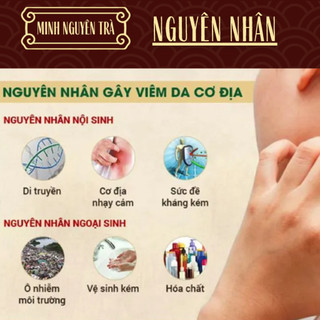 Trà Túi Lọc Thải Độc Da - Minh Nguyên - Viêm Da Cơ Địa, Chàm Da, Nấm, Ngứa, Bội Nhiễm, Vảy Nến, Á Sừng, Tổ Đỉa - 50 lọc