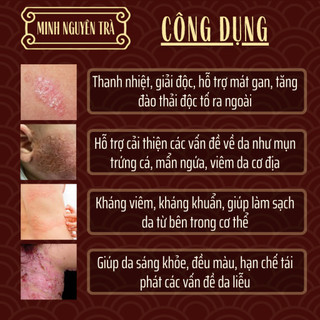 Trà Túi Lọc Thải Độc Da - Minh Nguyên - Viêm Da Cơ Địa, Chàm Da, Nấm, Ngứa, Bội Nhiễm, Vảy Nến, Á Sừng, Tổ Đỉa - 50 lọc