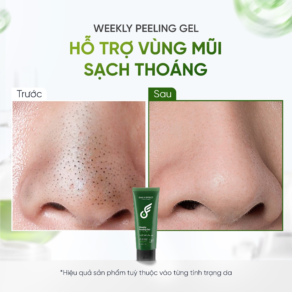 [Tẩy Tế Bào Chết Cho Da Dầu Mụn] DAILY EFFECT Weekly Peeling Gel (120ml)