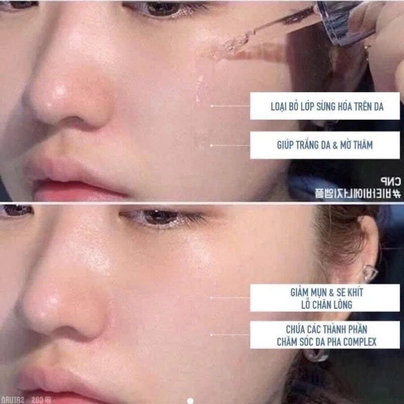 Sample Peel tái tạo da chuyên sâu CNP dưỡng trắng căng bóng mờ thâm nám lọ 2ml– CNP Rx Skin Rejuvenating Intensive Peel