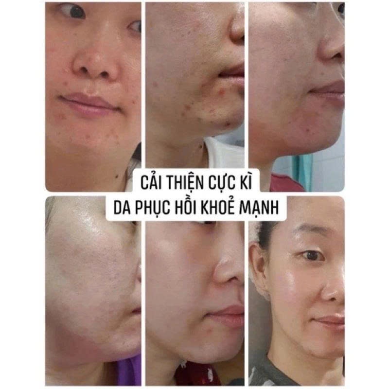 Sample Peel tái tạo da chuyên sâu CNP dưỡng trắng căng bóng mờ thâm nám lọ 2ml– CNP Rx Skin Rejuvenating Intensive Peel
