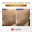 Huyết thanh vàng 24k Dr.Hedison Gold Activation Ampoule Serum