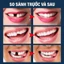 ​​EELHOE Kem Trám Răng Tạo Hình (Hộp 30ml)​ Bộ đồ dùng trang trí răng giả cho trẻ mọc răng Công cụ miễn phí