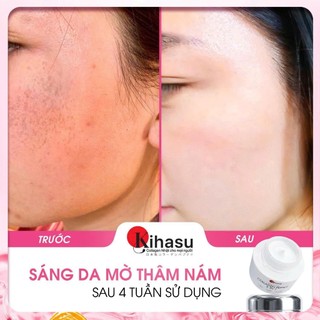 Combo 3 Hũ Kem Dưỡng Kihasu Collagen Peptide 6in1 Hỗ Trợ Căng Bóng, Trẻ Hóa, Cấp Ẩm Cho Làn Da