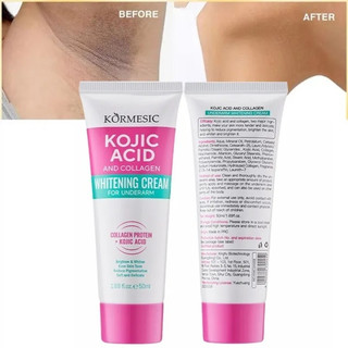 Trắng da kem trắng da 50ml Làm trắng vùng nách, vùng kín Kem Giảm Thâm Nách Mông Làm Trắng Da Dưỡng Ẩm Khử Mùi Hôi