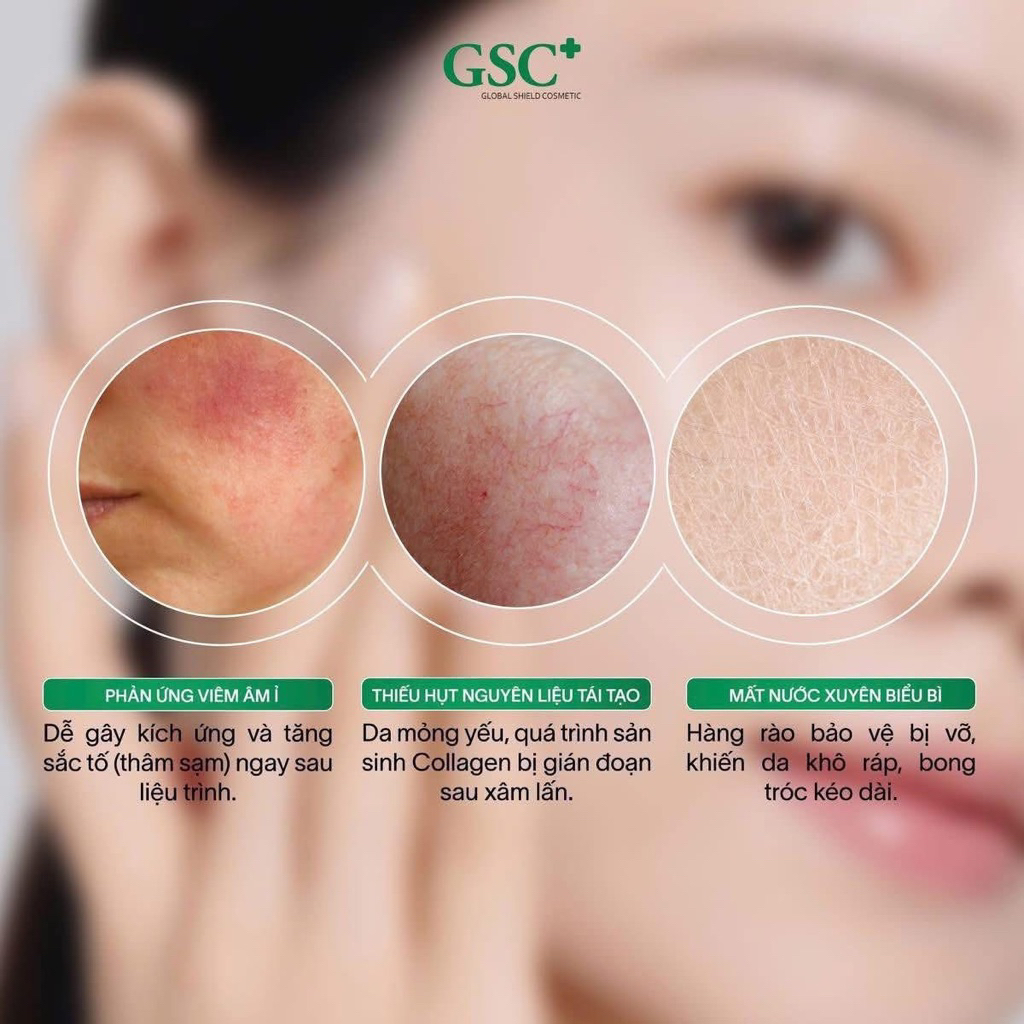 Serum Phục Hồi Da Giảm Đỏ Chống Lão Hóa GSC Advanced Repair Serum 15ml