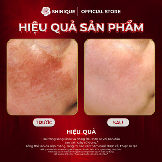 SHINIQUE MELA Skin Whitening Cream - Kem Dưỡng Da Hỗ Trợ Cải Thiện Nám và Không Đều Màu, Dưỡng Sáng Da - 30g