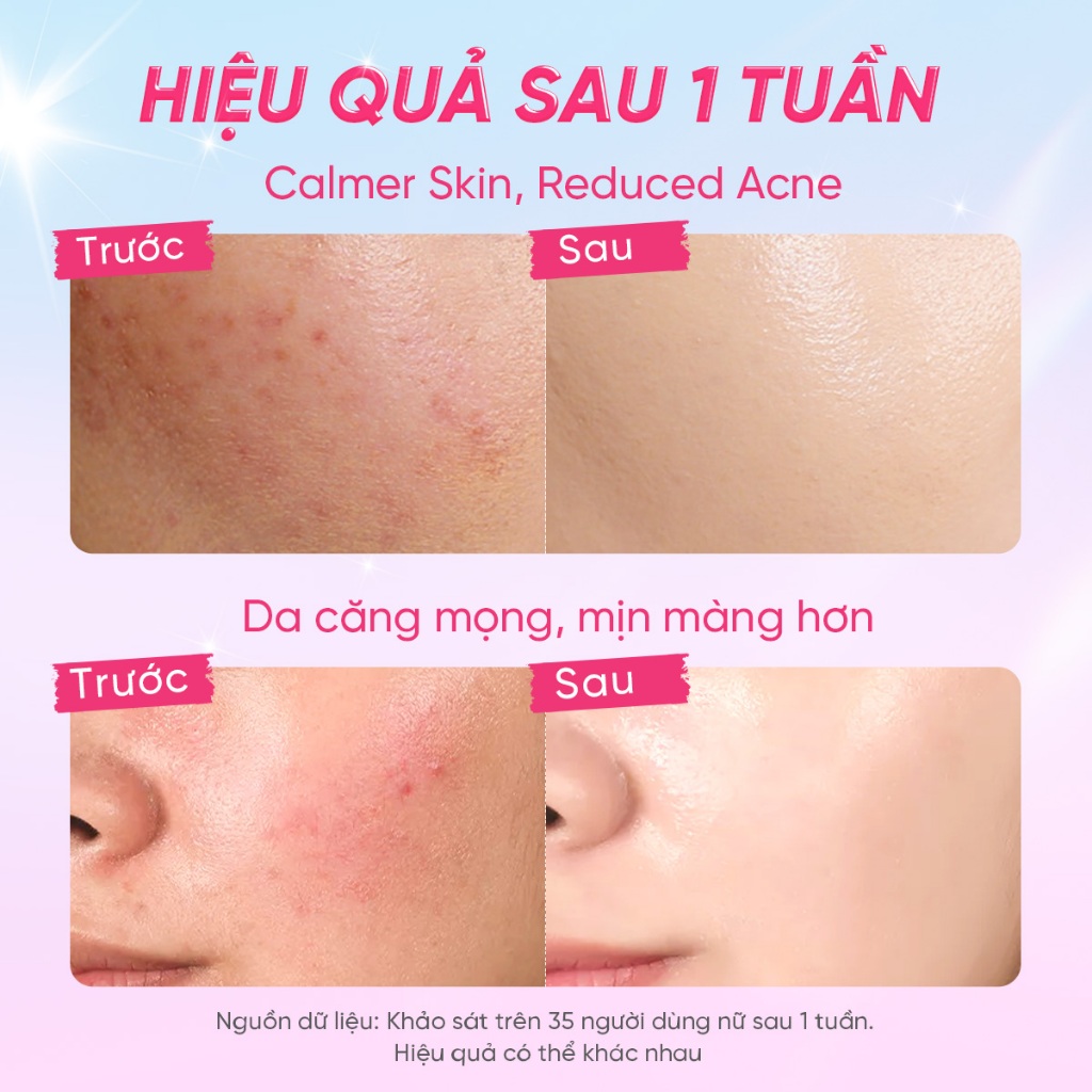 [MUA 2 GIẢM 44%] Combo 2 kem dưỡng ẩm The Originote dưỡng ẩm da mặt dưỡng ẩm makeup kem dưỡng da Moisturizer 50g*2