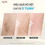 Máy Triệt Lông Mini MAXCARE, NĂNG LƯỢNG 24J Rút Ngắn Thời Gian Loại Bỏ Lông Vĩnh Viễn Tại Nhà, Triệt Lạnh IPL TRẺ HÓA DA — ảnh 6