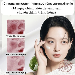 Kem chuyên mờ nám, tàn nhang, dưỡng trắng da 377 RUY - Cấp ẩm cho da, giúp da sáng mịn, trong trẻo và mềm mại