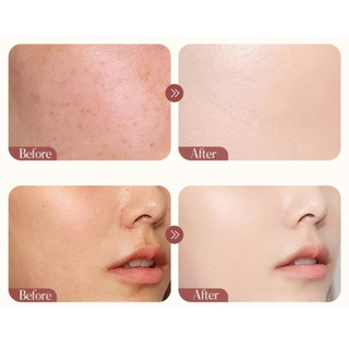 Kem chuyên mờ nám, tàn nhang, dưỡng trắng da 377 RUY - Cấp ẩm cho da, giúp da sáng mịn, trong trẻo và mềm mại