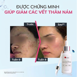 Serum Collagen Kihasu Dưỡng Sáng Da, Cấp Ẩm, Giúp Da Mềm Mịn, Chứa Vitamin C Và Niacinamide