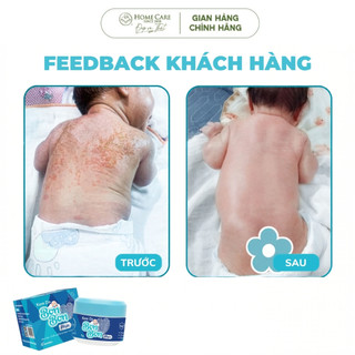 Kem Da Bôi Chống Chàm Sữa Cho Bé Yêu, Kem Da Bon Bon Plus Home Care Chính Hãng