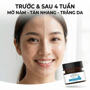 Kem nám tàn nhang FRECKLE CREAM Kem xóa nám mờ nám tàn nhang đồi mồi dưỡng ẩm da phục hồi da chống lão hoá
