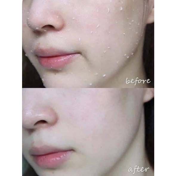 Tẩy Da Chết Mịn Dr.Pepti Herb Natural Peeling Gel Chiết Xuất 16 Thảo Dược 130ml -ThyLee