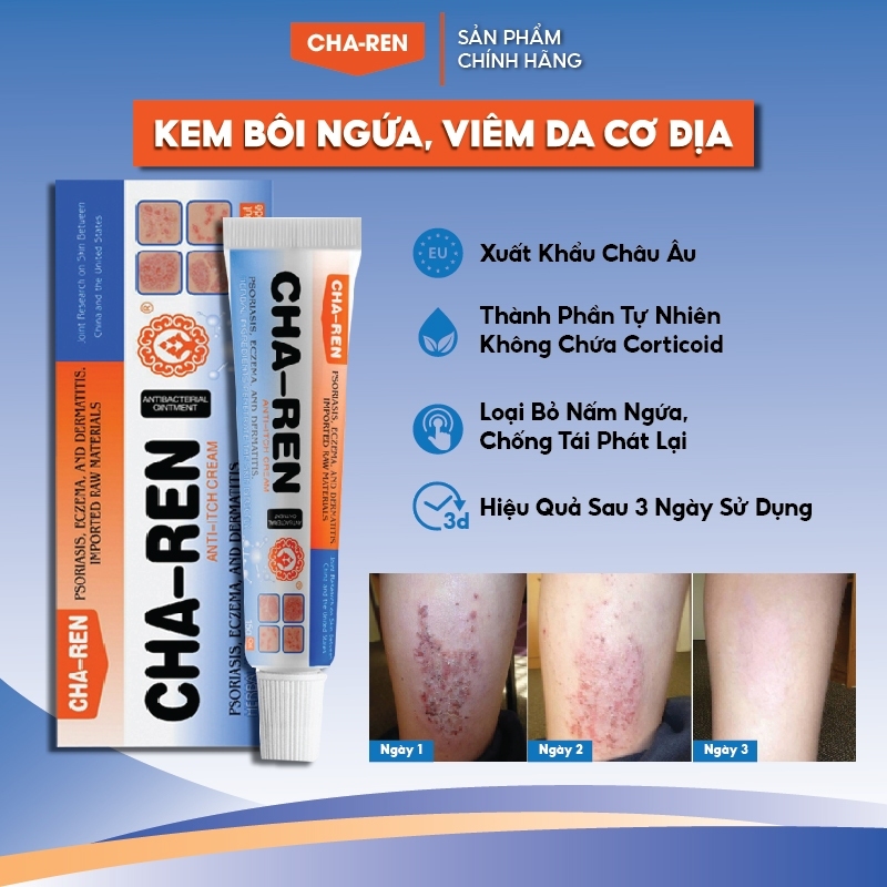 Kem Bôi Viêm Da Cơ Địa CHA-REN Hàng Xuất Khẩu Châu Âu (EU) Hỗ Trợ Dứt Điểm Hắc Lào, Nấm Da Đầu, Ghẻ Nước, Á Sừng